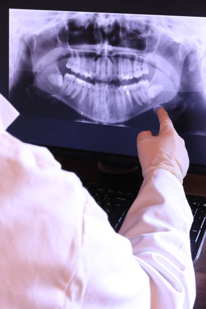 Best Walk-In Emergency Dentist in Wellford, SC
